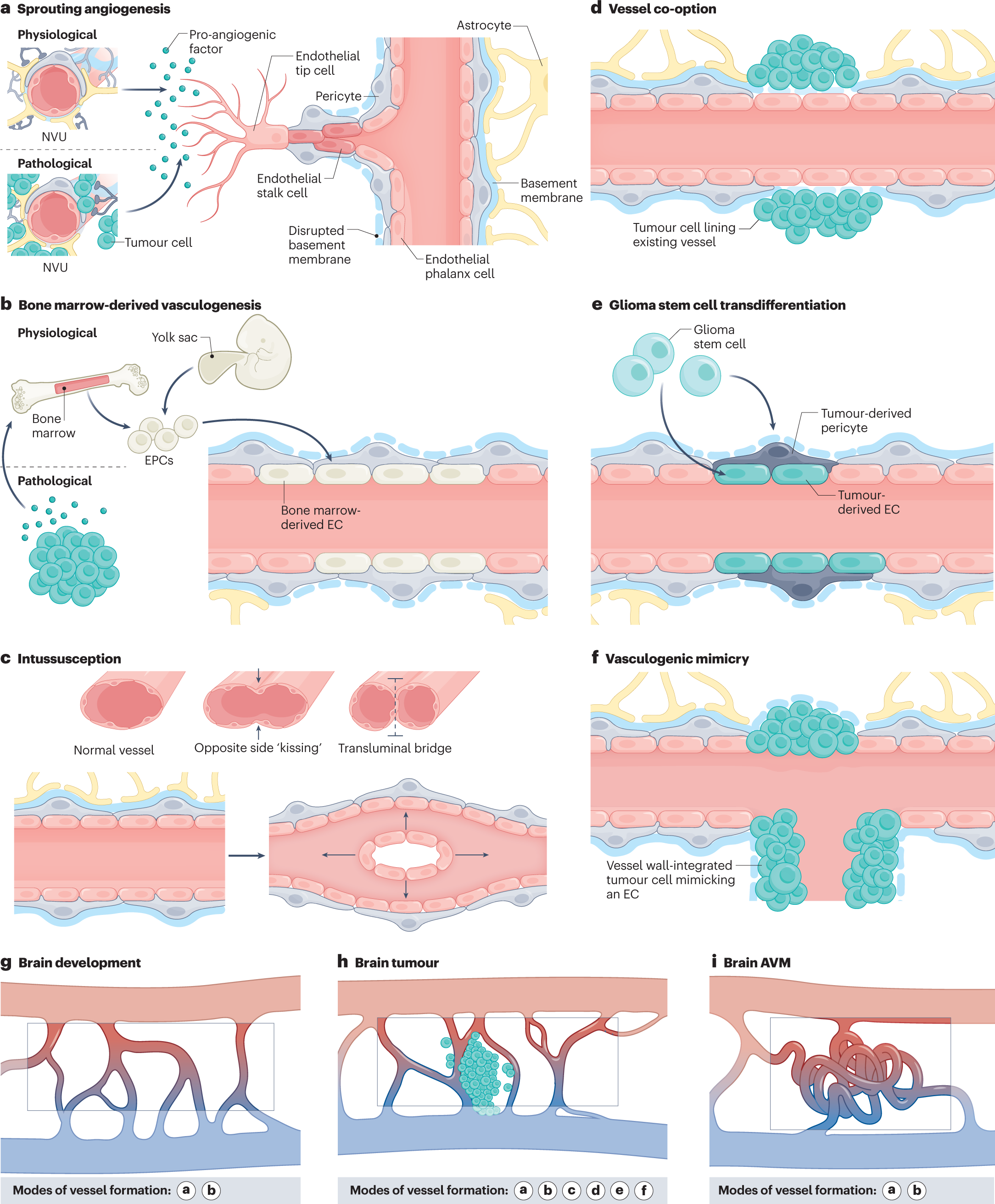 Shaping the brain vasculature in development and disease in the single-cell  era | Nature Reviews Neuroscience