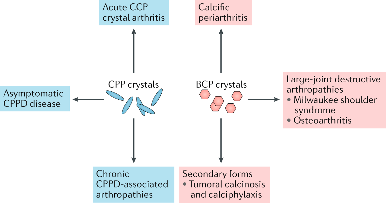 gout vs pseudogout crystals