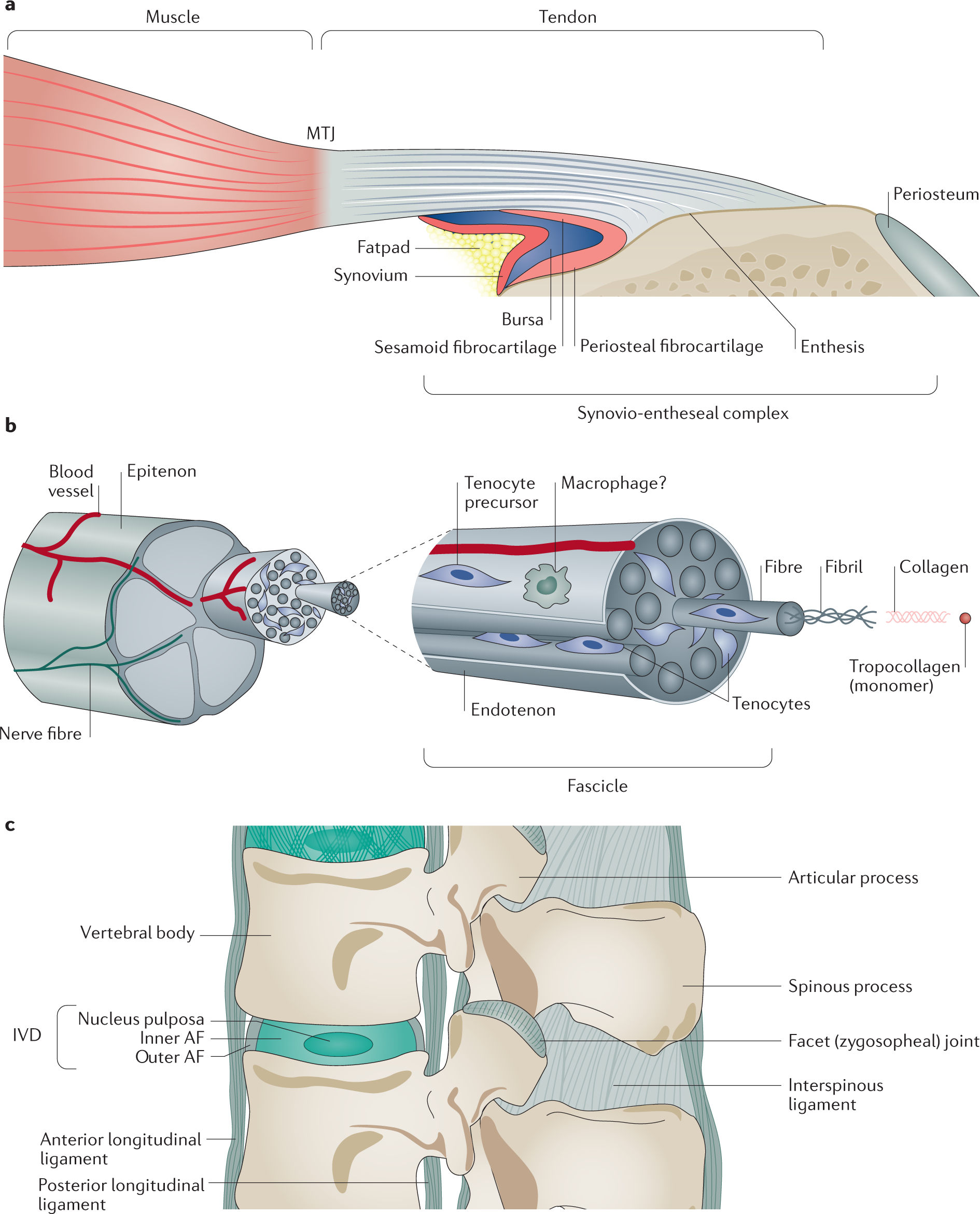 Tendon and ligament mechanical loading in the pathogenesis of inflammatory  arthritis | Nature Reviews Rheumatology