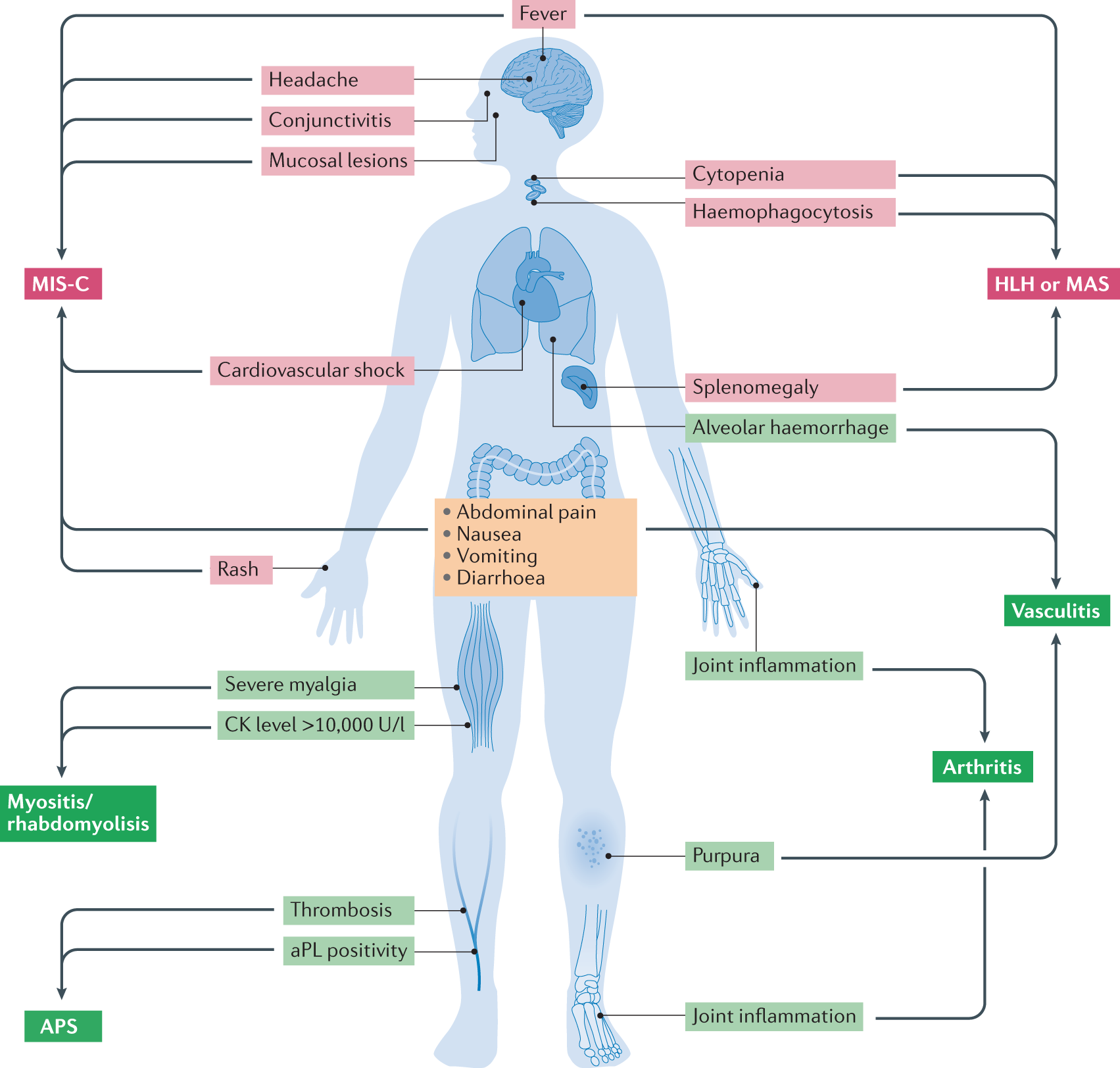 Systemic and organ-specific immune-related manifestations of COVID-19 |  Nature Reviews Rheumatology