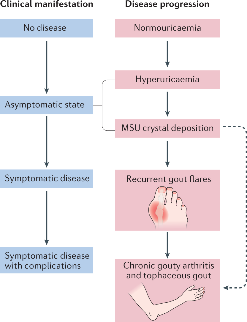 Management of gout in chronic kidney disease: a G-CAN Consensus Statement  on the research priorities | Nature Reviews Rheumatology