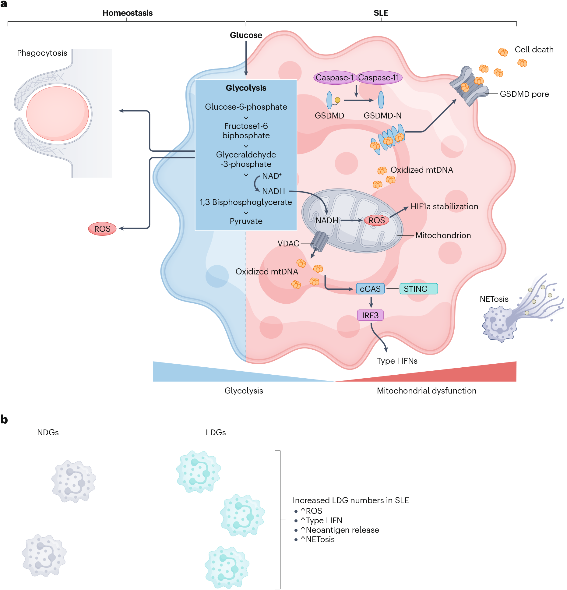 Immunometabolism in systemic lupus erythematosus