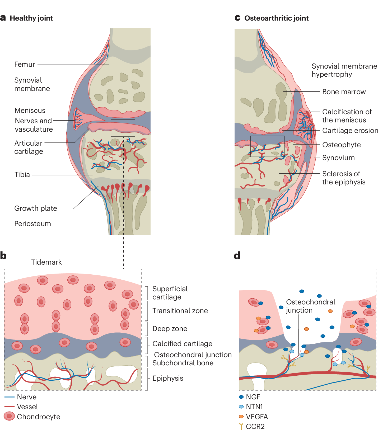 Peripheral neuronal sensitization and neurovascular remodelling in  osteoarthritis pain | Nature Reviews Rheumatology