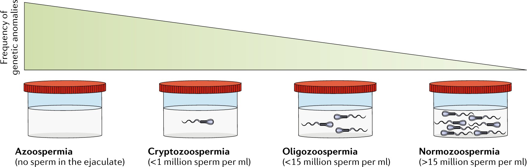 Genetics Of Male Infertility Nature Reviews Urology