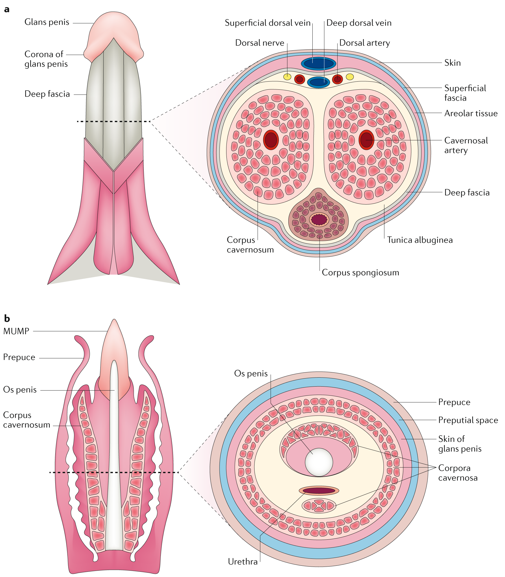 Head dots of penis around Penile cancer