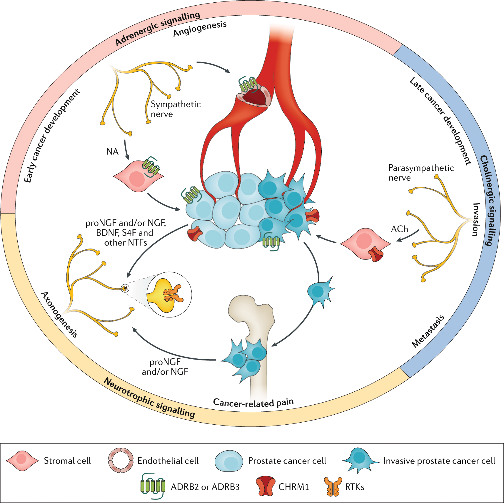 ganglion prostate cancer