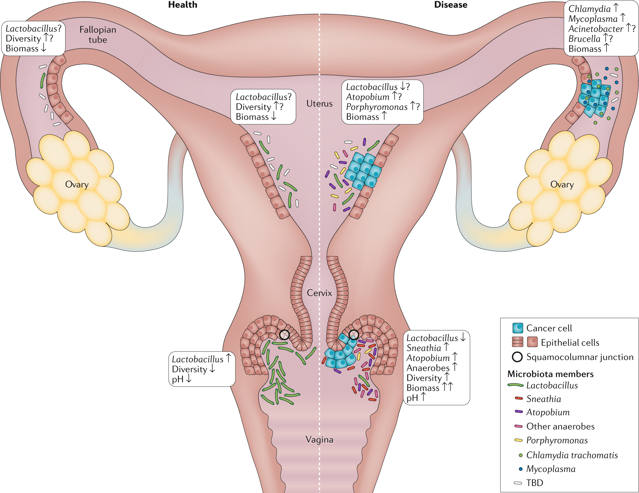 The microbiome and gynaecological cancer development, prevention and therapy Nature Reviews Urology