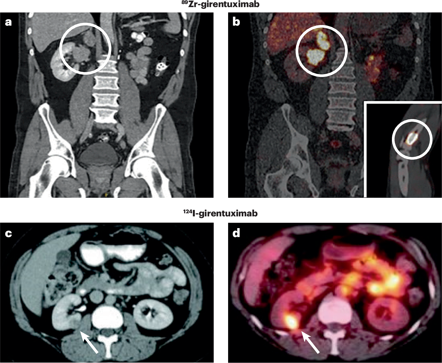 Molecular imaging of renal cell carcinomas: ready for prime time | Nature  Reviews Urology