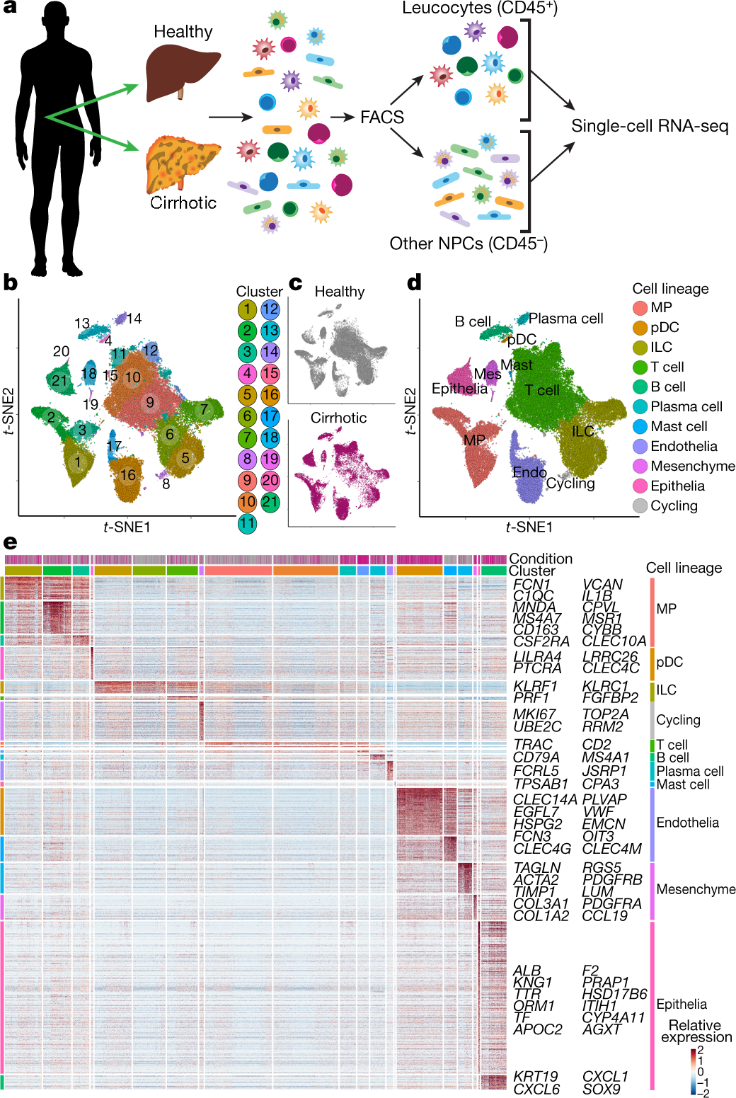 Resolving the fibrotic niche of human liver cirrhosis at single-cell level  | Nature