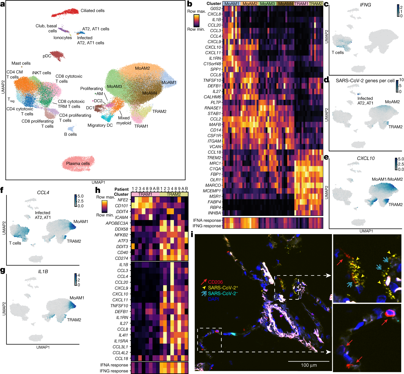 Fig. 4: Single-cell RNA-seq identifies a positive feedback loop between IFNγ-producing T cells and SARS-CoV-2-infected alveolar macrophages.