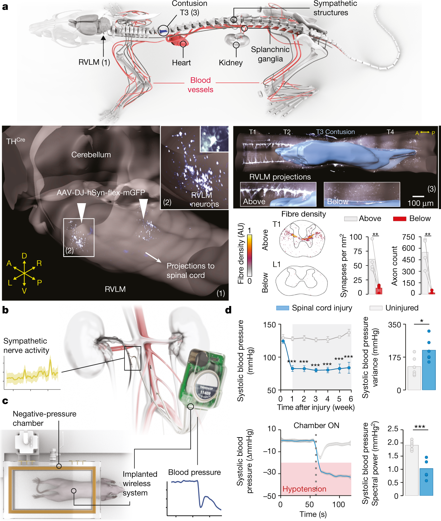 Neuroprosthetic baroreflex controls haemodynamics after spinal cord injury  | Nature