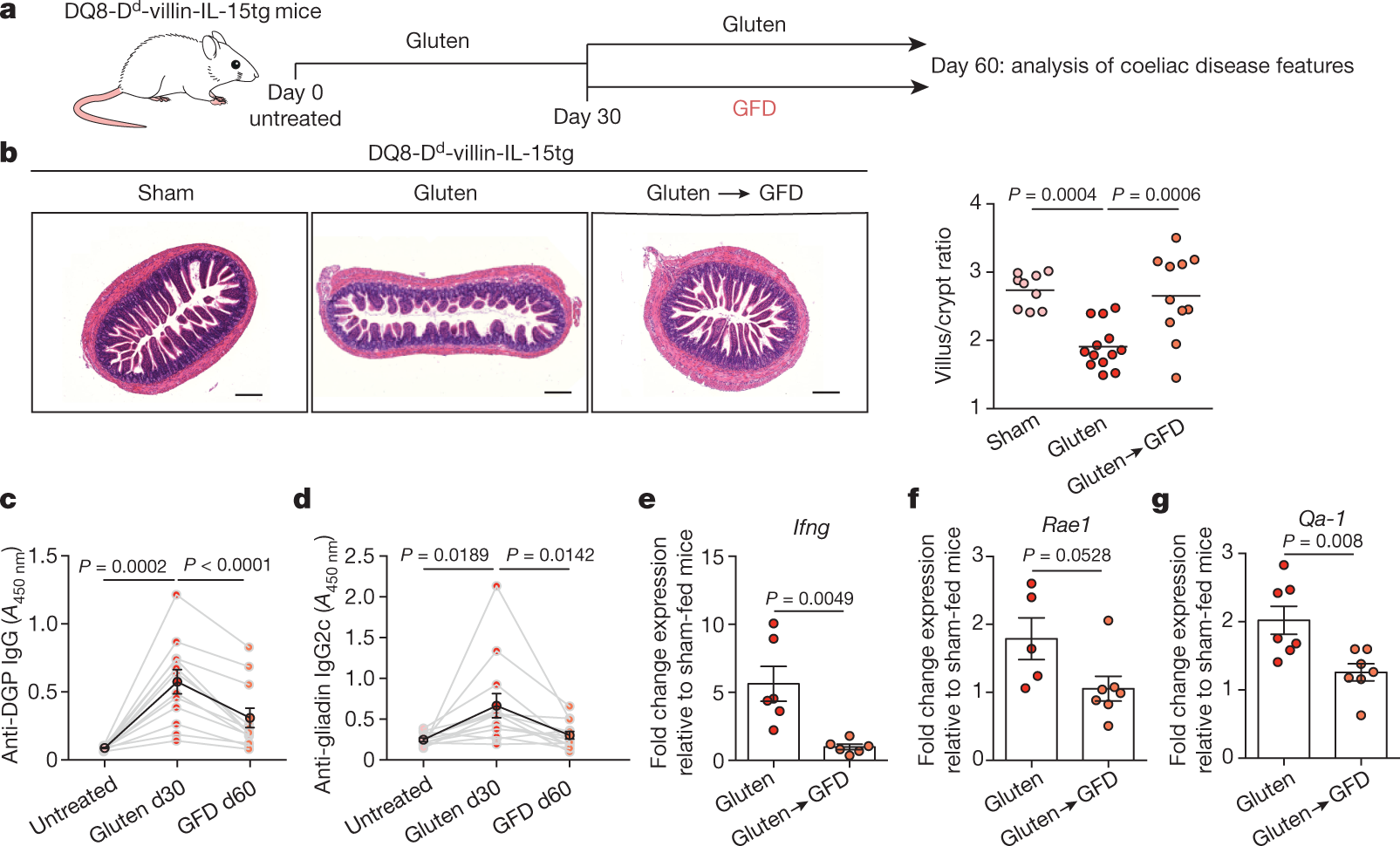 IL-15, gluten and HLA-DQ8 drive tissue destruction coeliac disease Nature