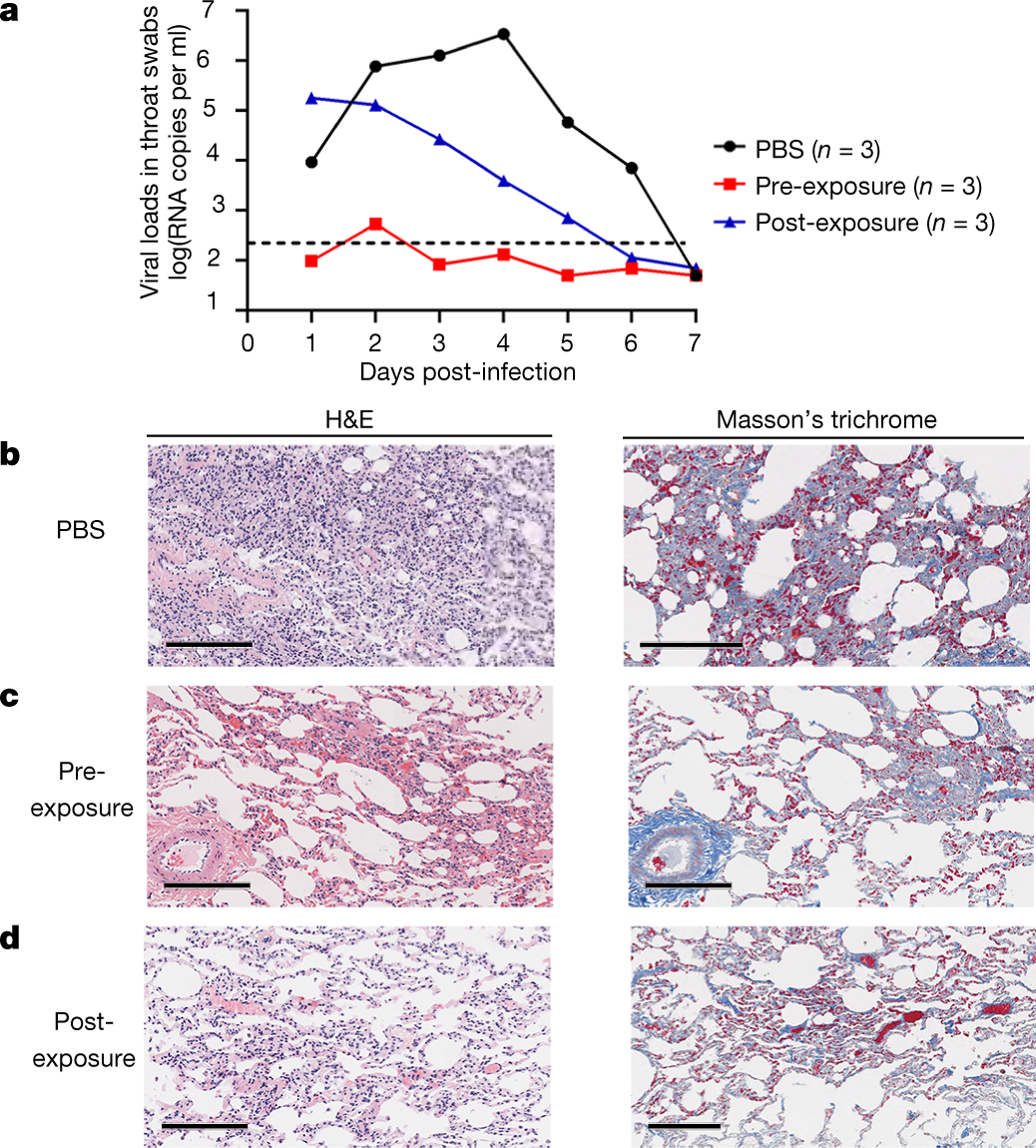 Fig. 3: CB6 can effectively reduce viral load and alleviated infection-related lung damage in rhesus macaques.