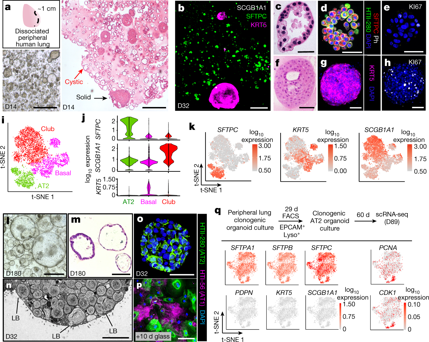Progenitor identification and SARS-CoV-2 infection in human distal lung  organoids | Nature