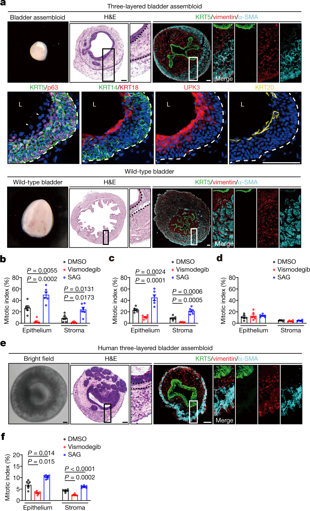 Creation of bladder assembloids mimicking tissue regeneration and cancer |  Nature