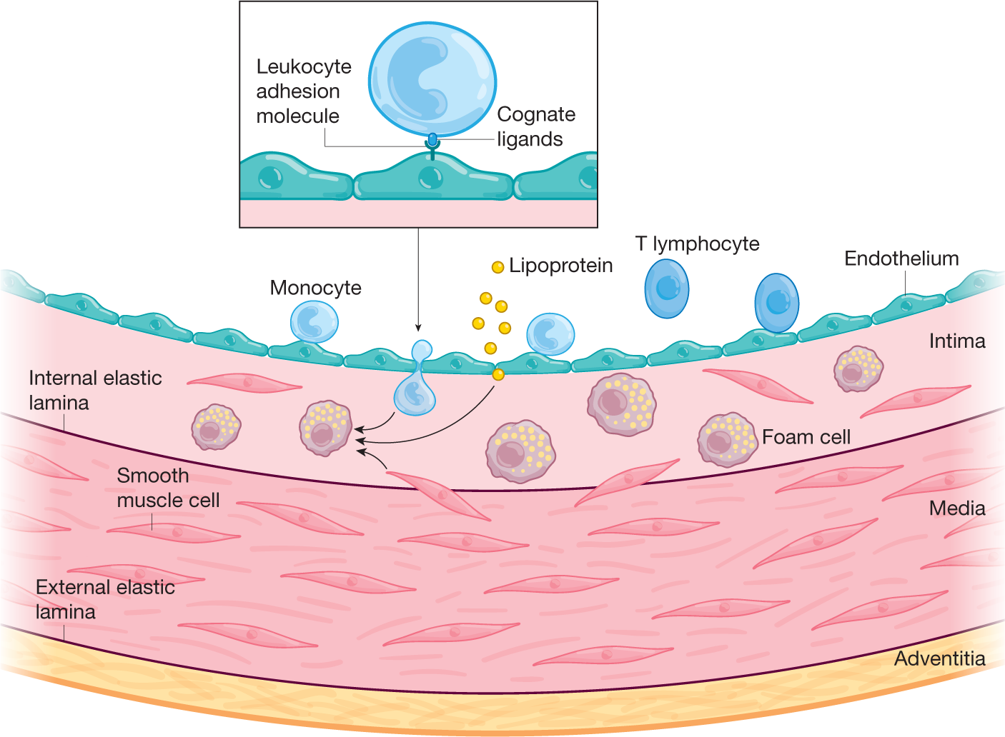 Frontiers  Characteristics and evaluation of atherosclerotic plaques: an  overview of state-of-the-art techniques