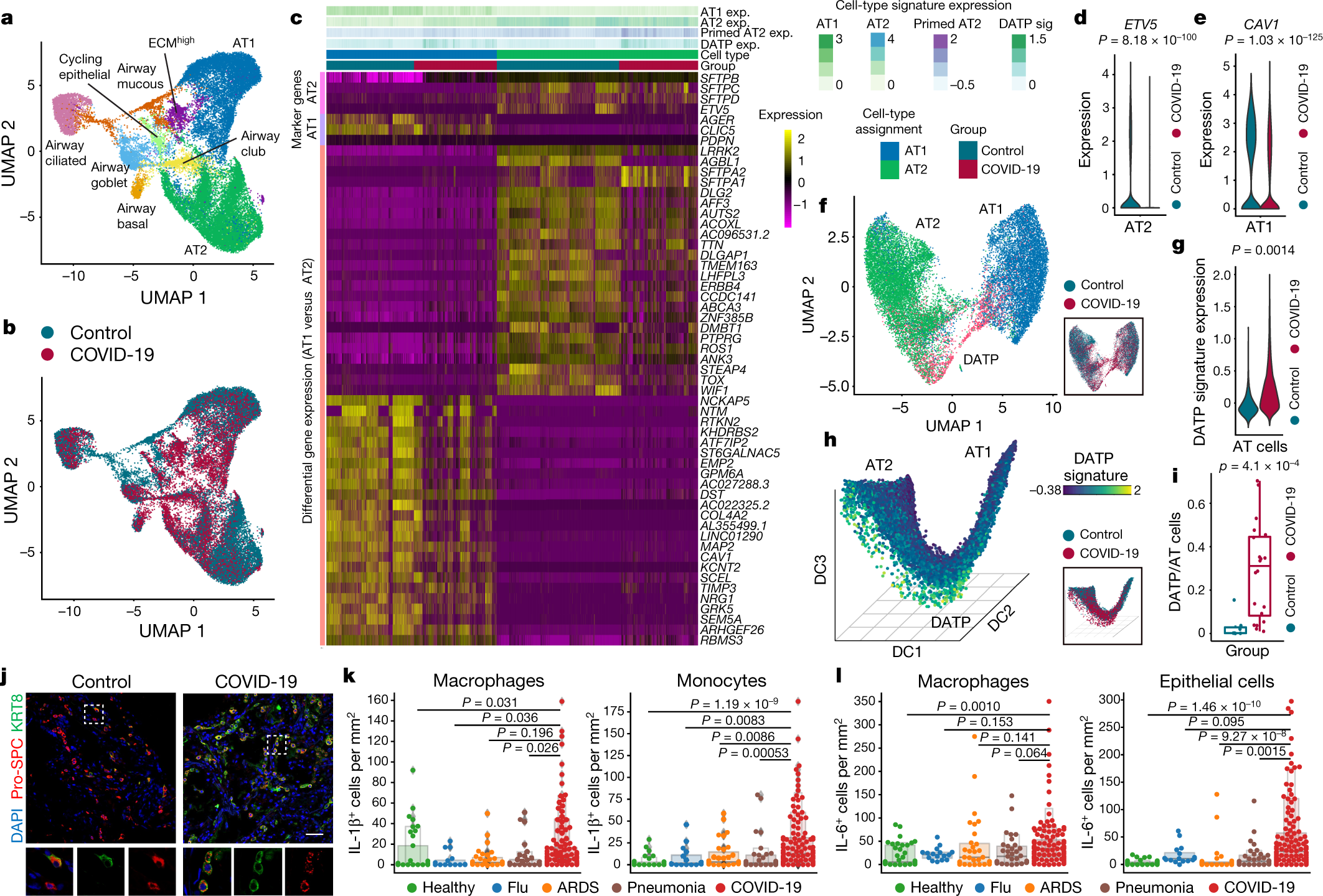 Fig. 3: Impaired lung regeneration and sources of inflammation.