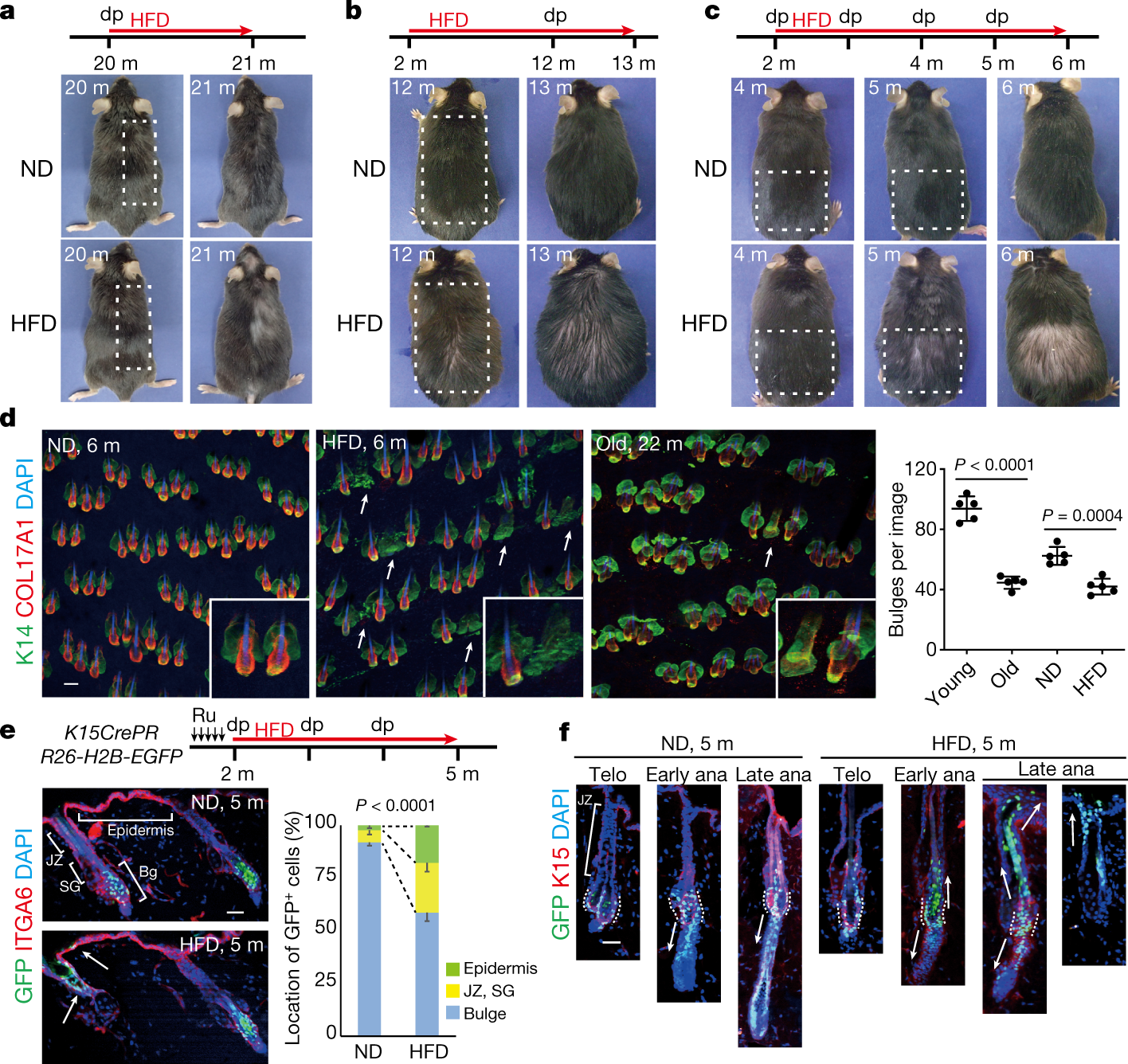 Obesity accelerates hair thinning by stem cell-centric converging  mechanisms | Nature