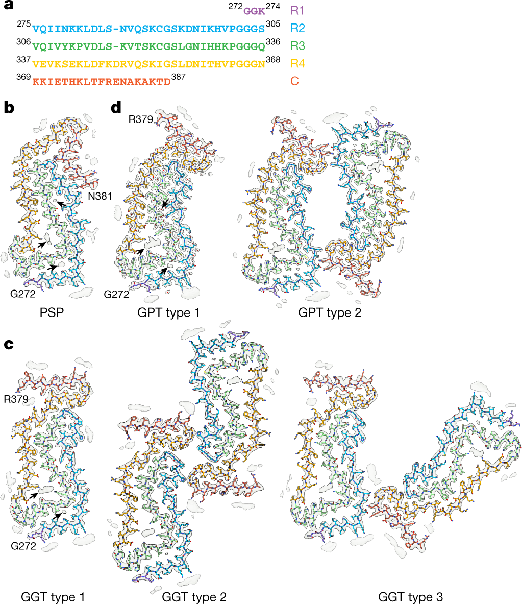 Structure-based classification of tauopathies | Nature