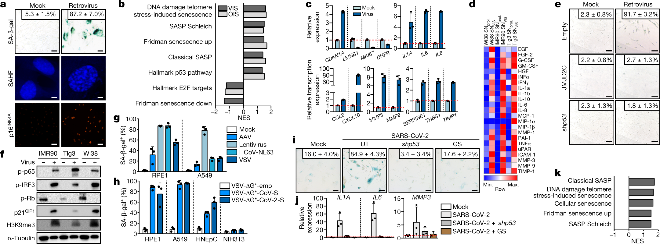 Virus-induced senescence is a driver and therapeutic target in COVID-19 |  Nature