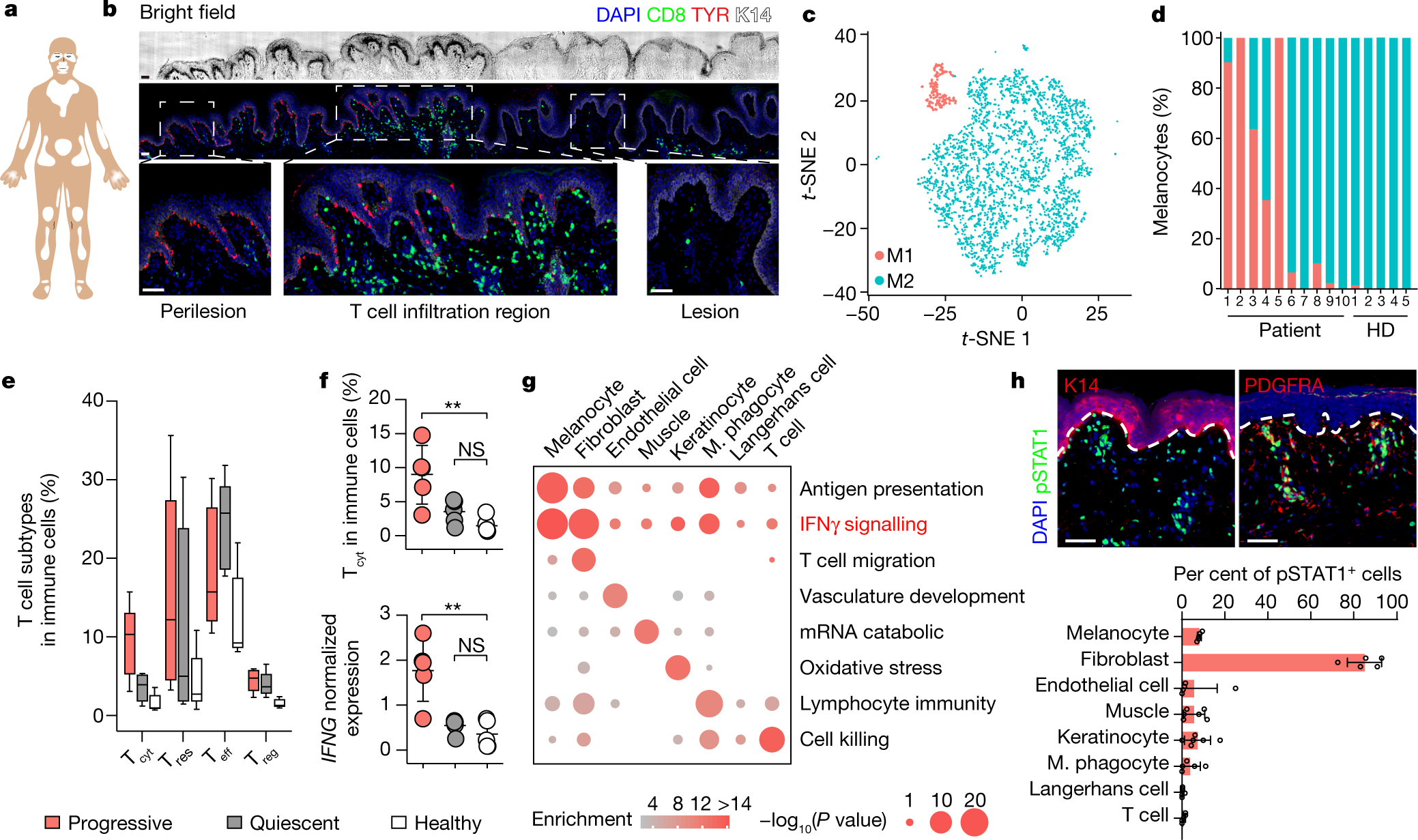 Anatomically distinct fibroblast subsets determine skin autoimmune patterns  | Nature