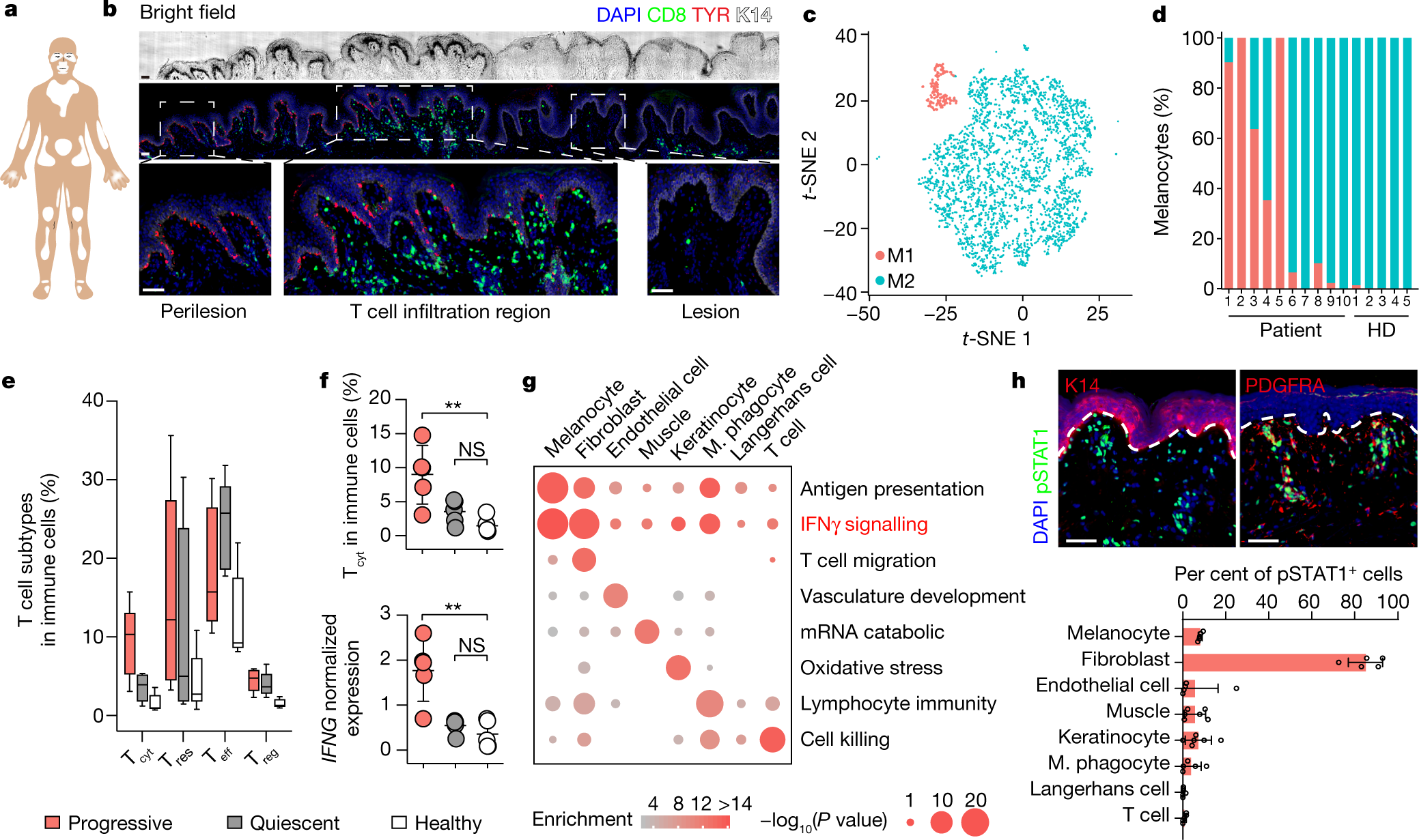 Anatomically Distinct Fibroblast Subsets Determine Skin Autoimmune Patterns Nature