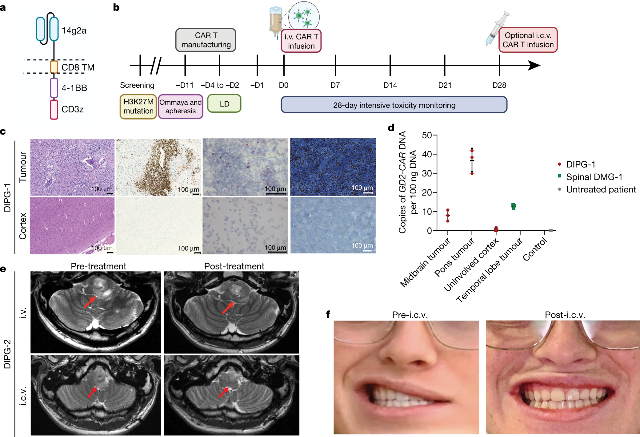 Transient rest restores functionality in exhausted CAR-T cells through  epigenetic remodeling