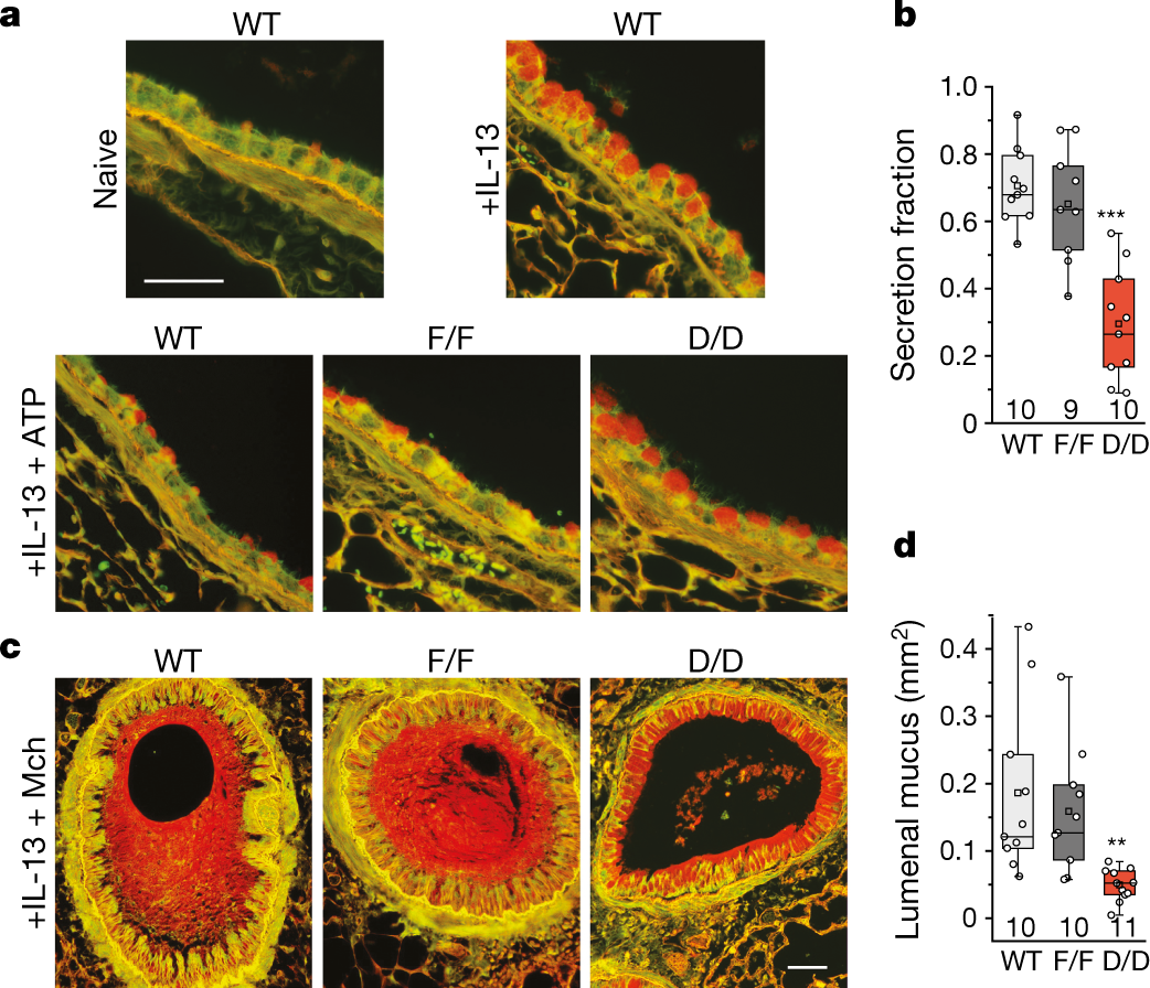 Inhibition of calcium-triggered secretion by hydrocarbon-stapled peptides |  Nature