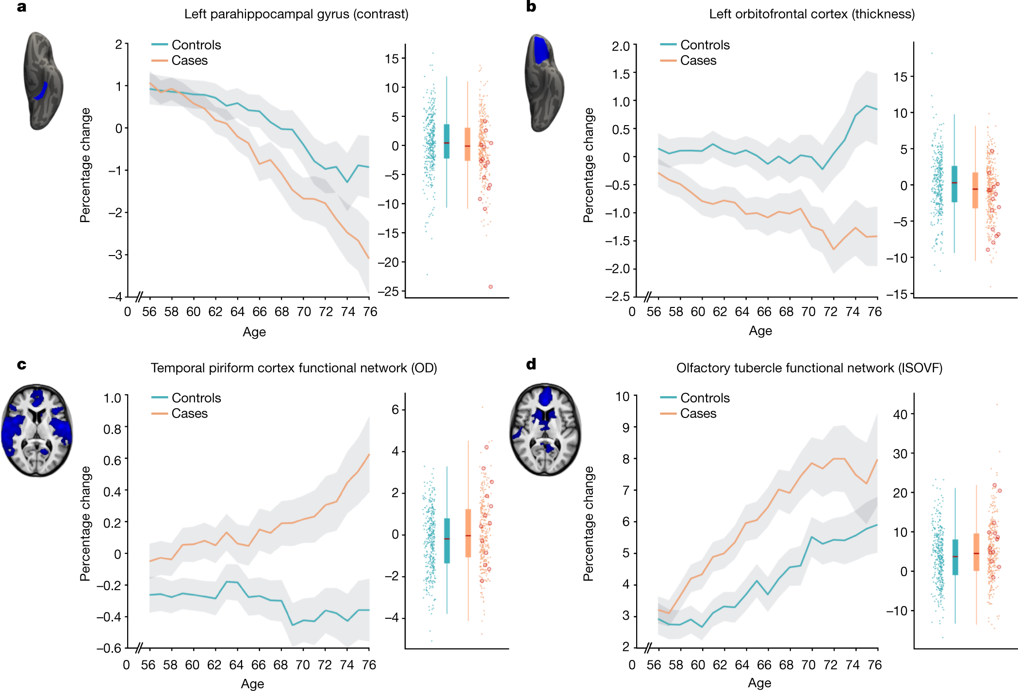 SARS-CoV-2 is associated with changes in brain structure in UK Biobank |  Nature