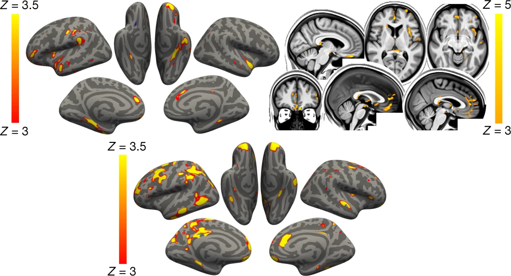 Fig. 2: Vertex-wise and voxel-wise longitudinal group differences in grey matter thickness and mean diffusivity changes.
From: SARS-CoV-2 is associated with changes in brain structure in UK Biobank