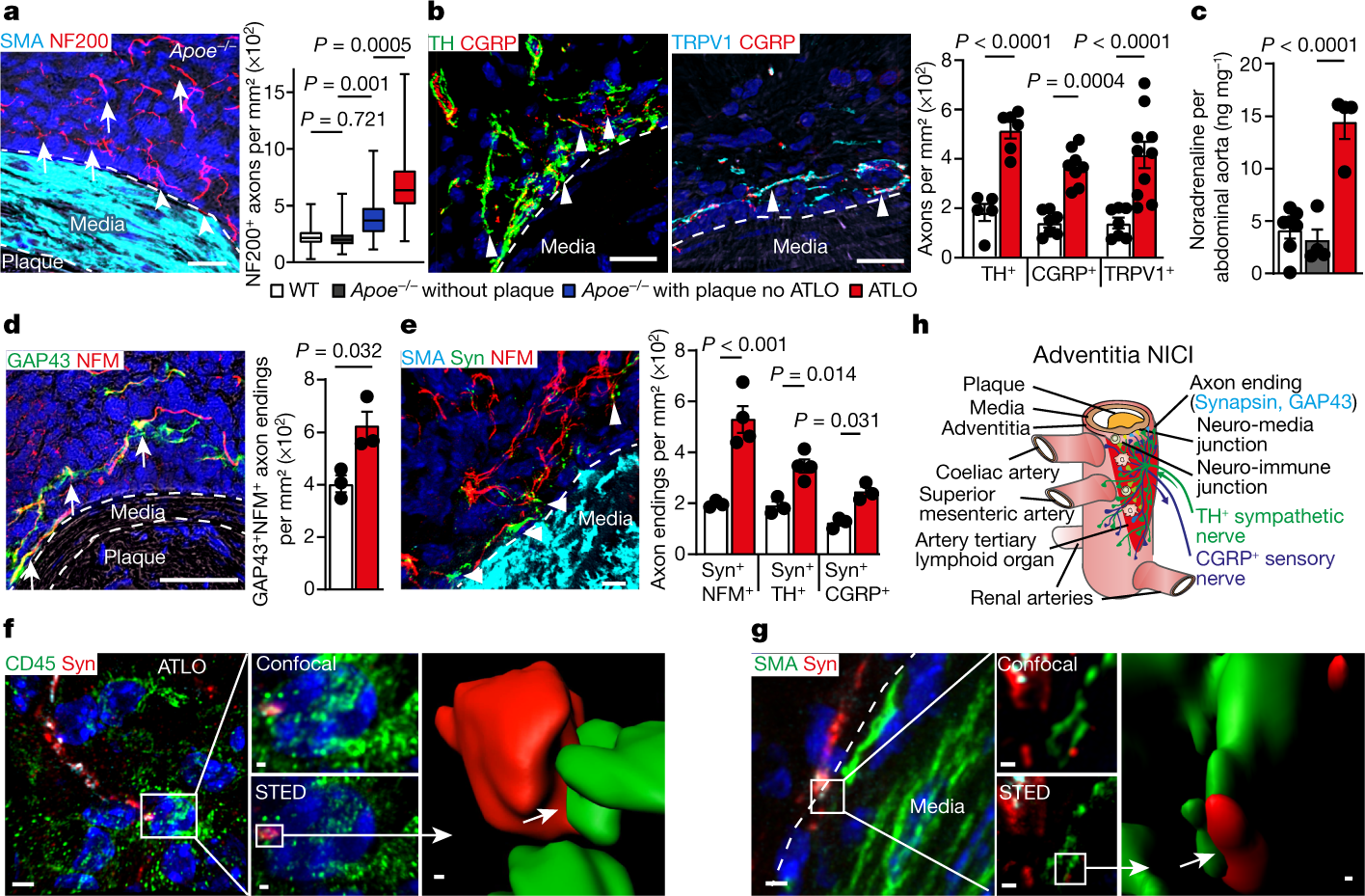 Neuroimmune cardiovascular interfaces control atherosclerosis | Nature