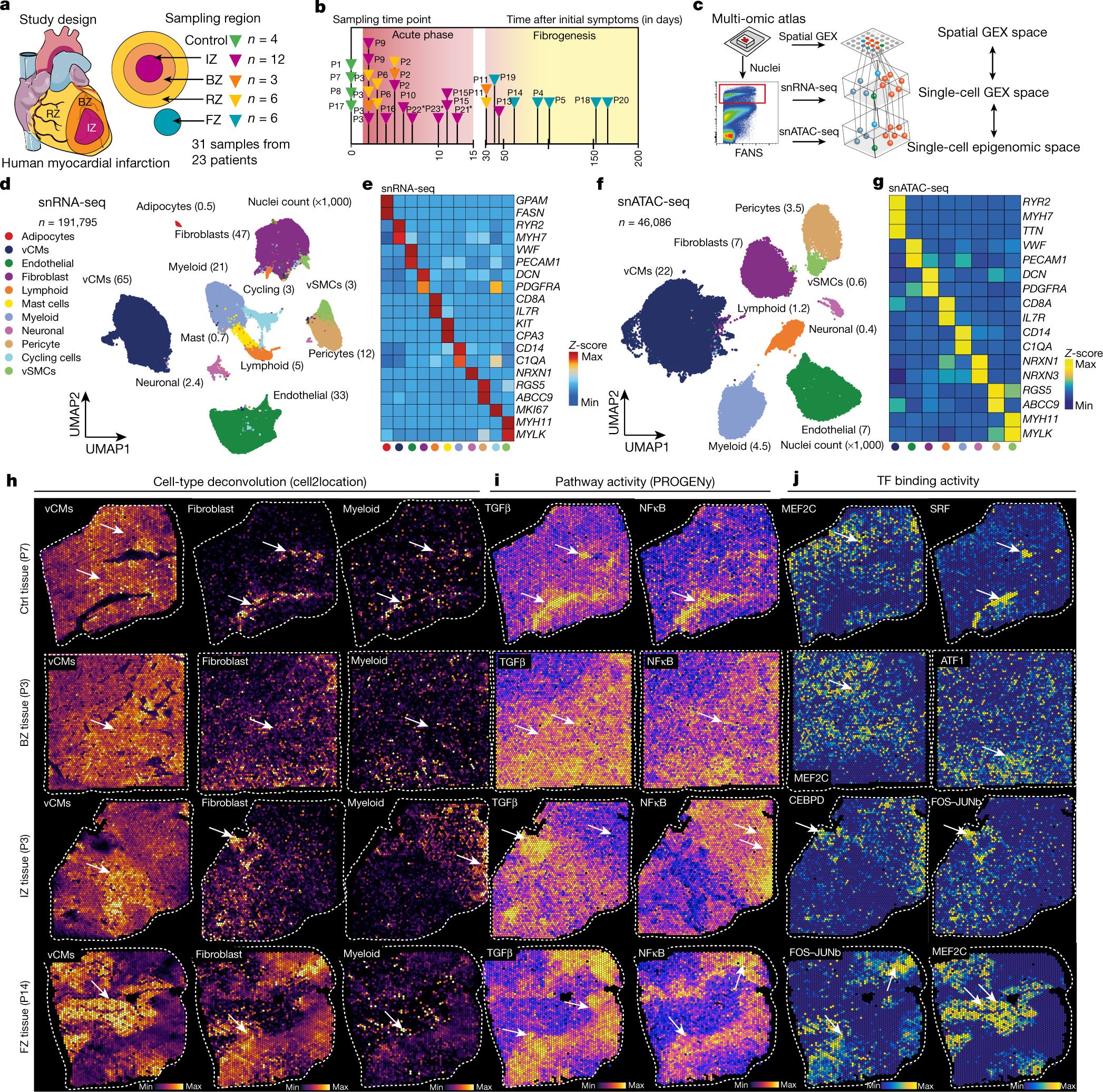 Spatial multi-omic map of human myocardial infarction | Nature