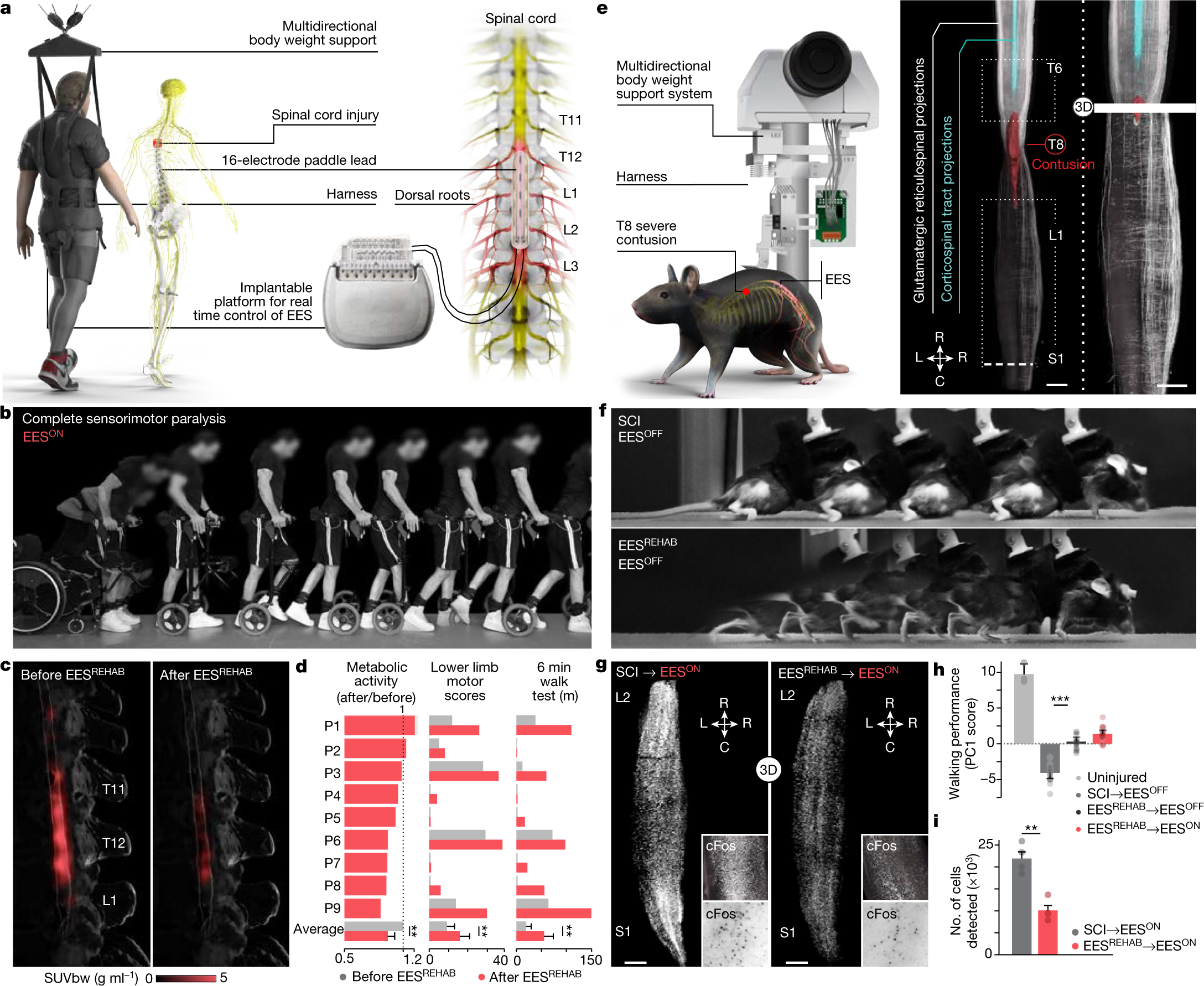 The neurons that restore walking after paralysis | Nature