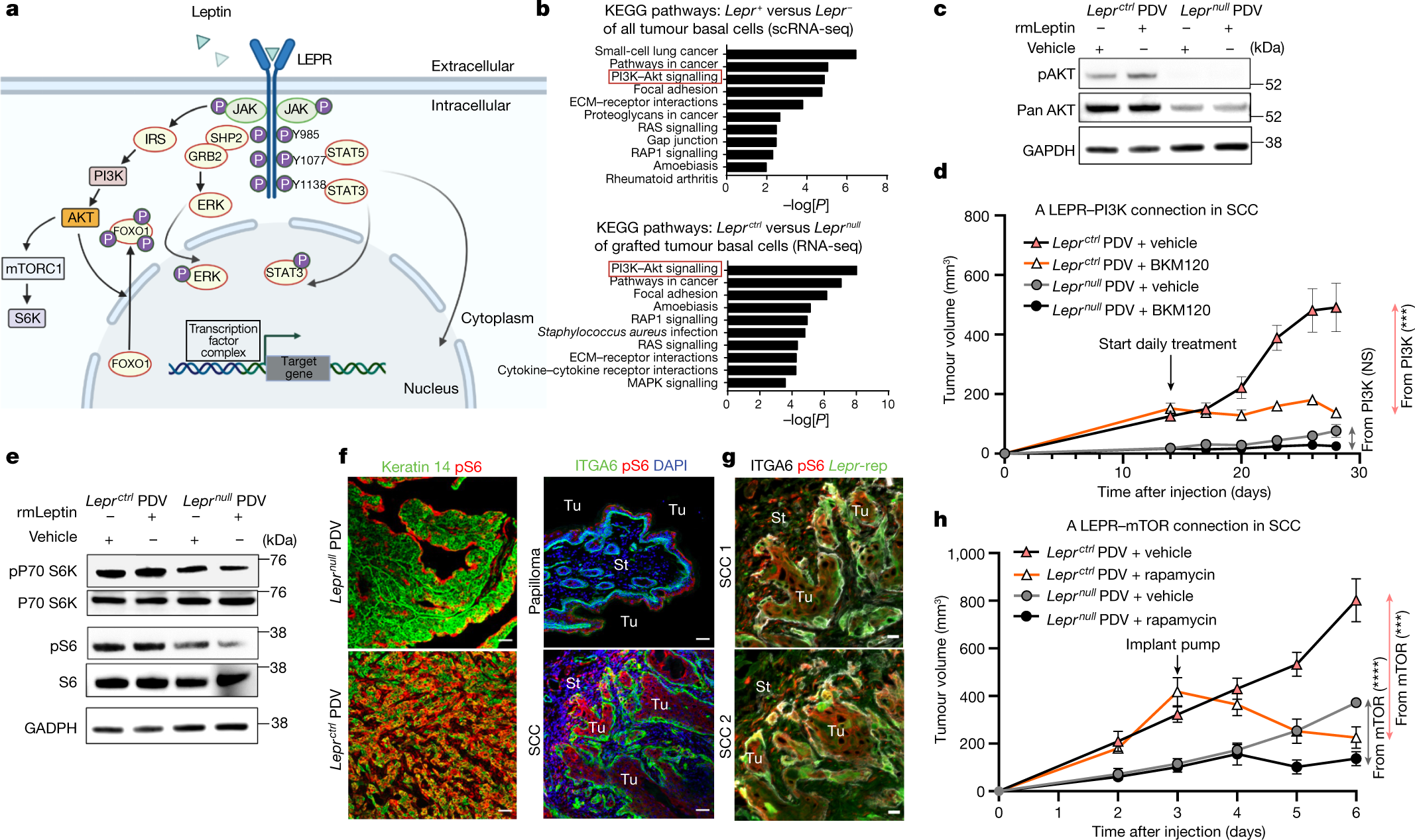Fig. 5: Leptin receptor signalling promotes SCC progression through the PI3K–AKT and mTOR pathways.