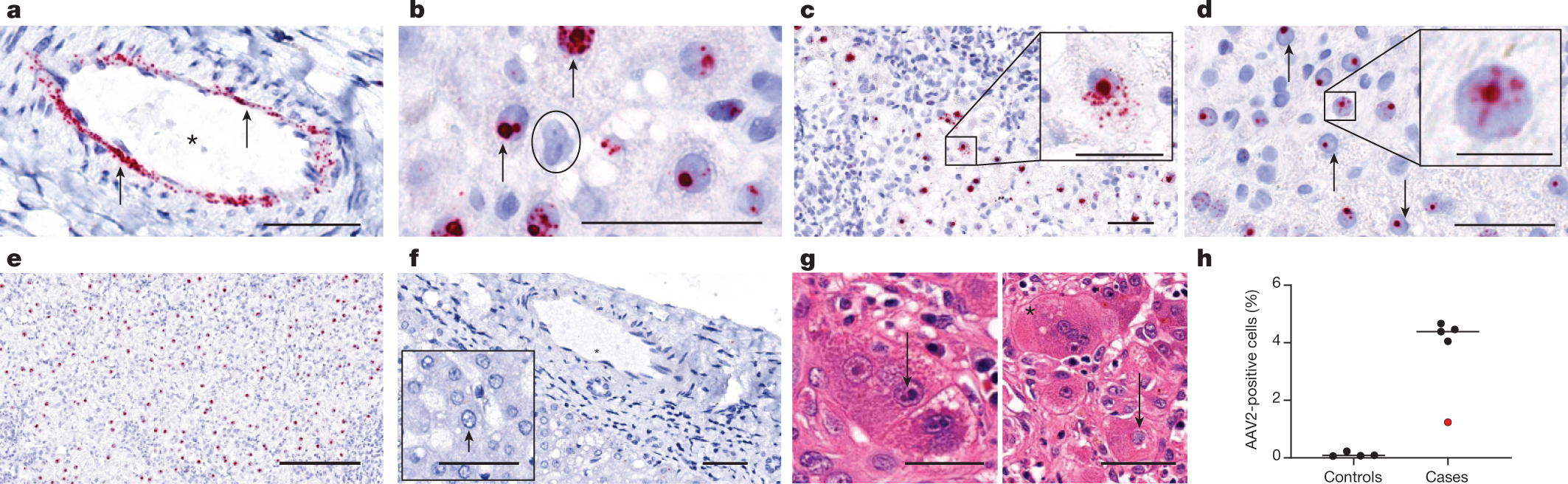 Fig. 3: ISH of AAV2 in liver tissue.