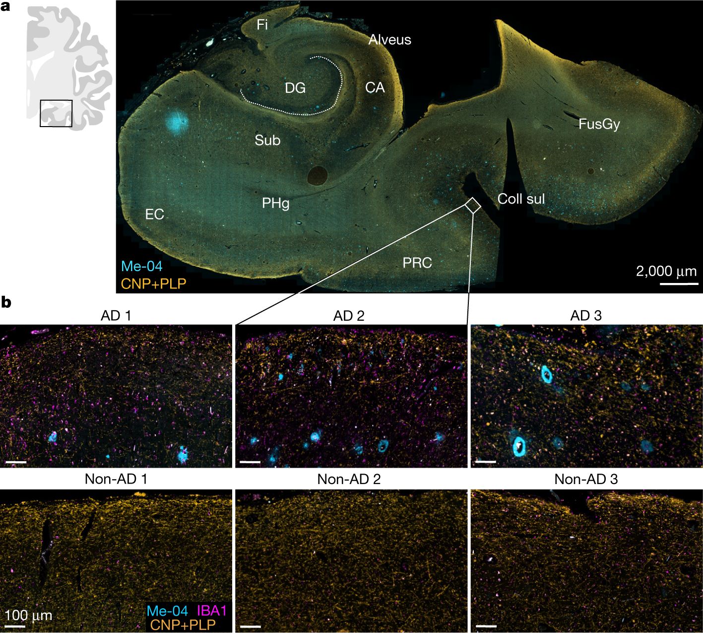 Myelin dysfunction drives amyloid-β deposition in models of