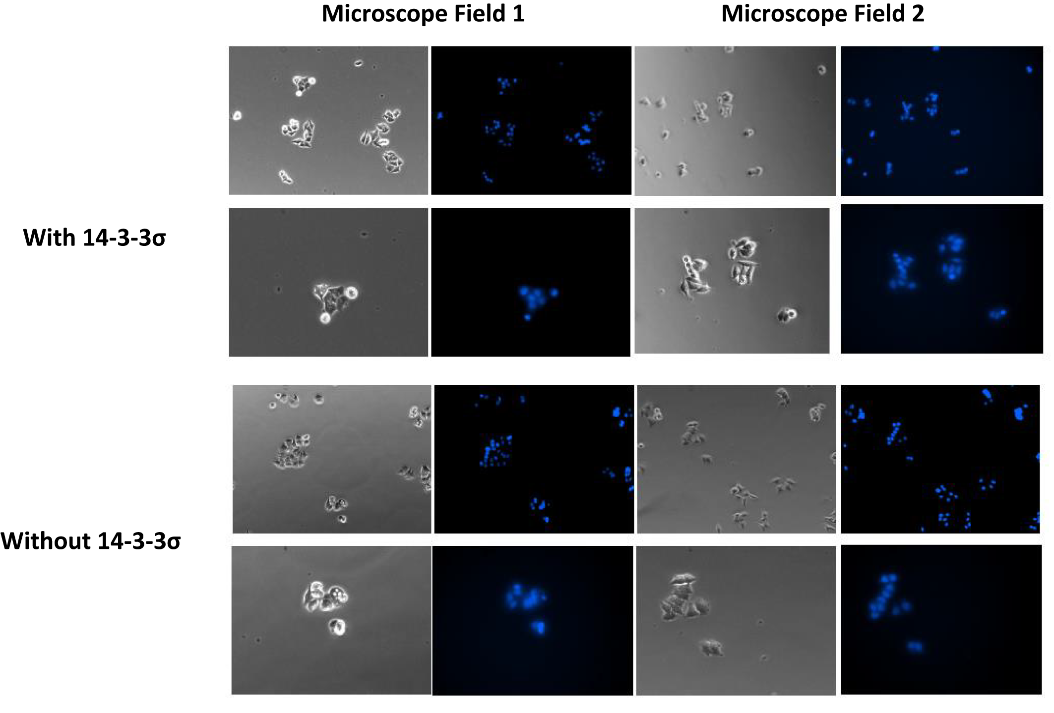Fig. 1: Images of untreated cells with and without 14-3-3σ. The cells described in the original Chan et al. study were frozen in 1999, thawed 23 years later (2022), passaged once, and stained with Hoechst 33258 (Thermo-Fisher catalog number H3569).