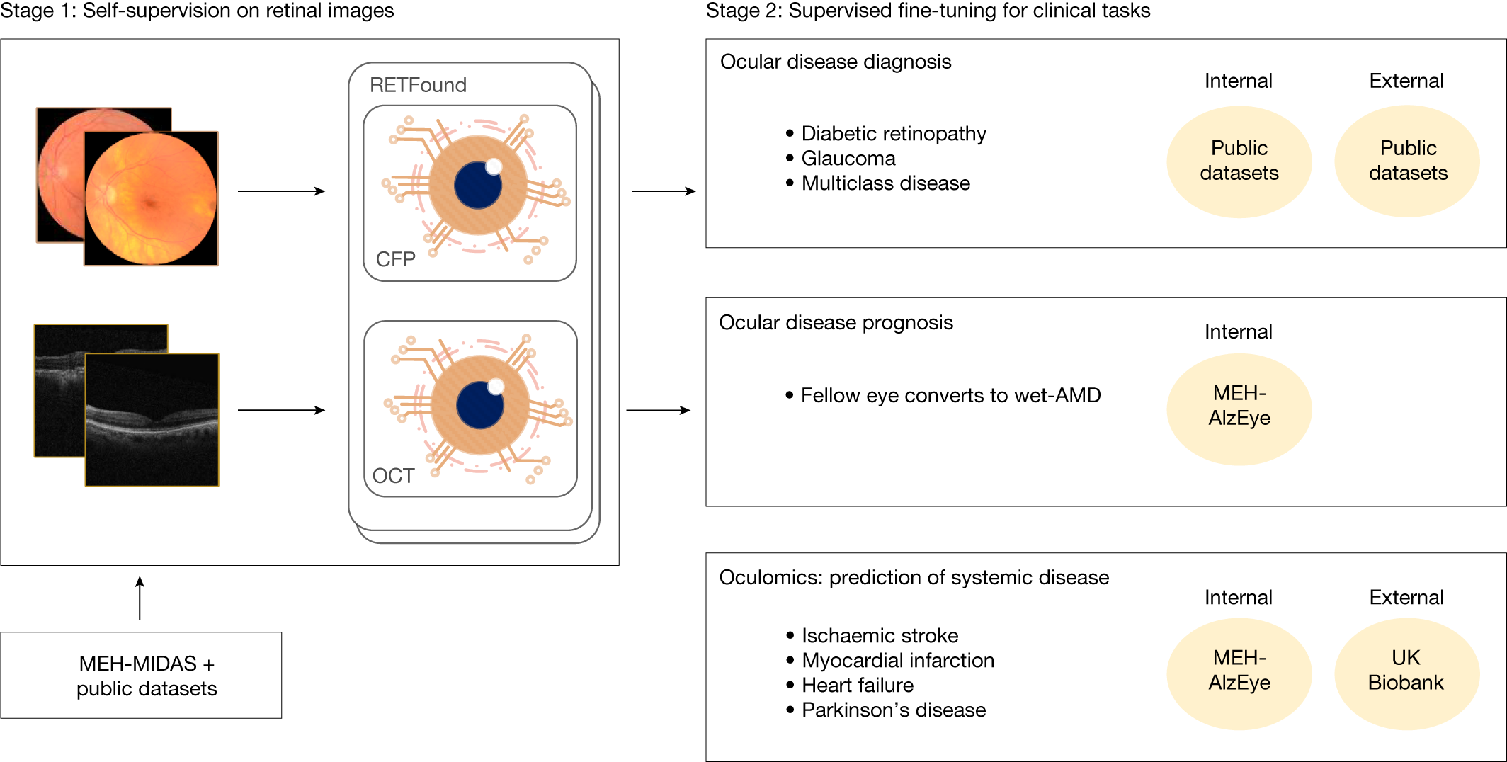 Layers of the Retina - Discovery Eye Foundation