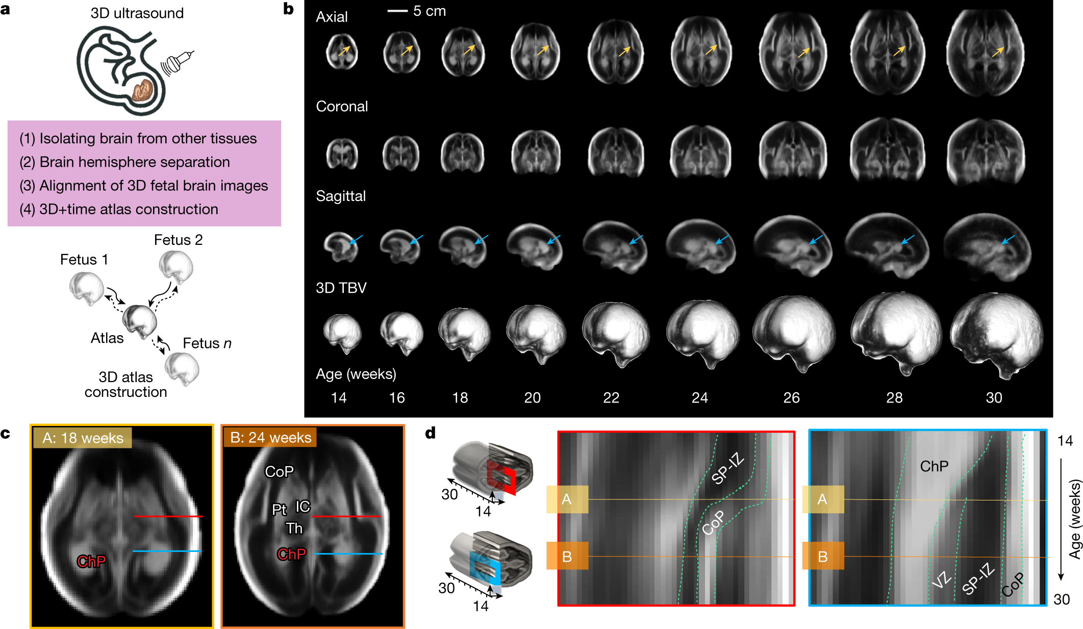 Normative spatiotemporal fetal brain maturation with satisfactory  development at 2 years