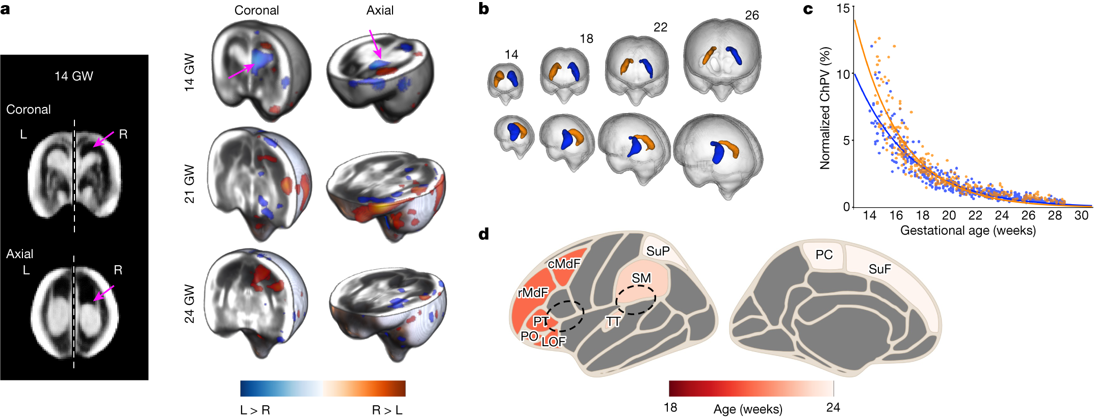 Fig. 5: Earliest detection of structural fetal brain hemispheric asymmetries.
