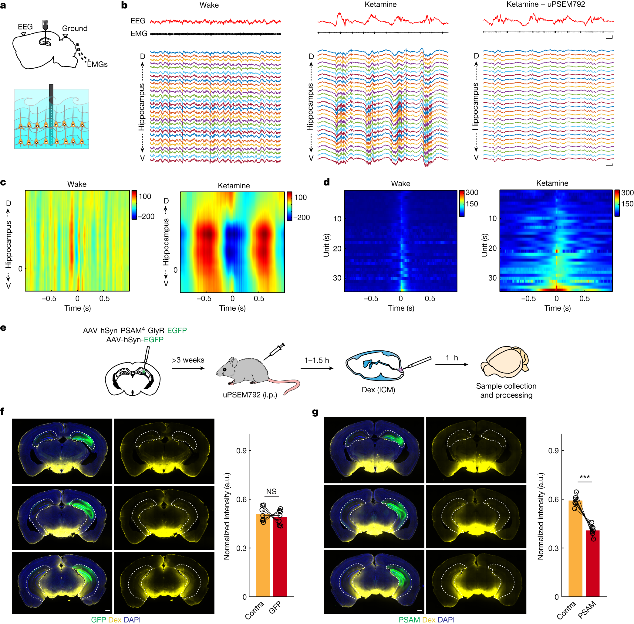 Neuronal dynamics direct cerebrospinal fluid perfusion and brain clearance - Vimarsana News