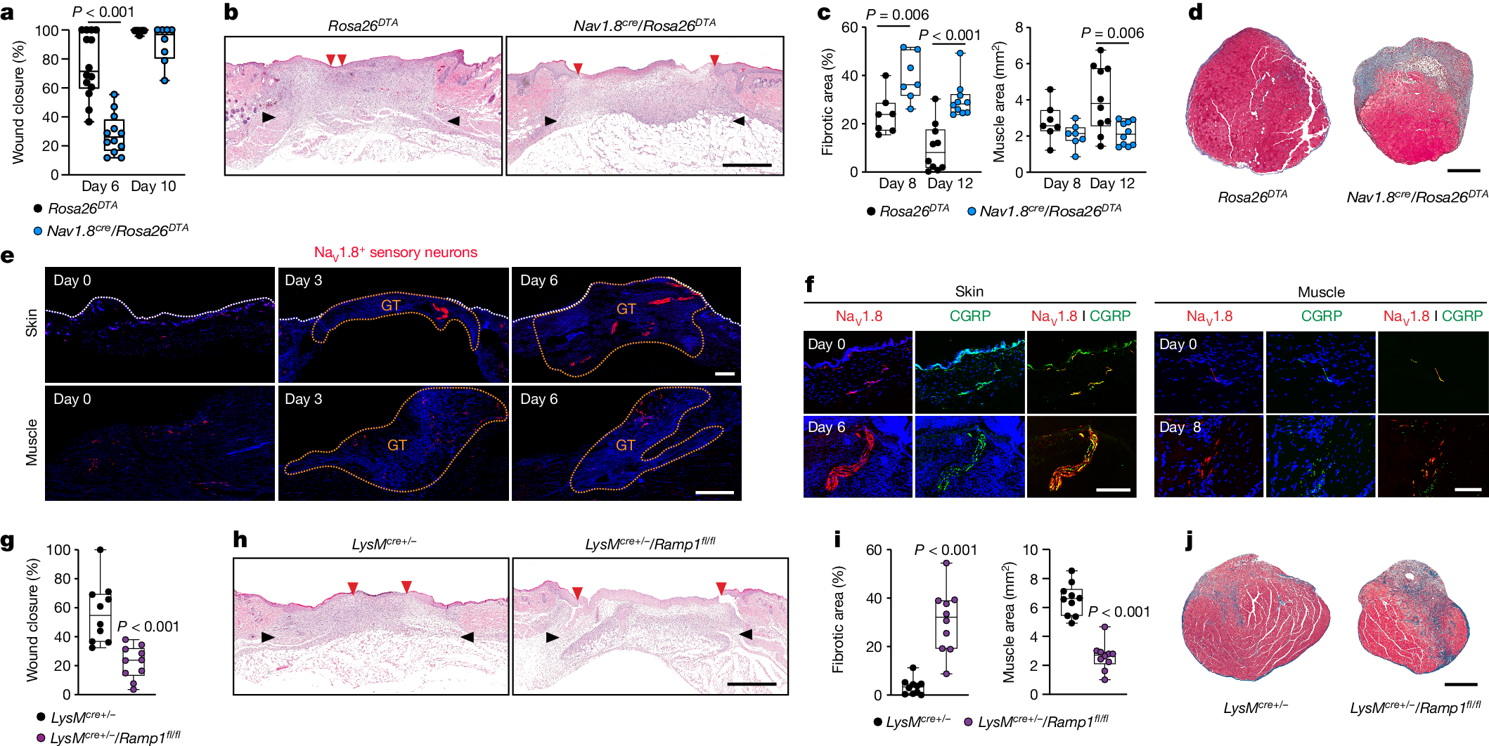 CGRP sensory neurons promote tissue healing via neutrophils and macrophages - Vimarsana News