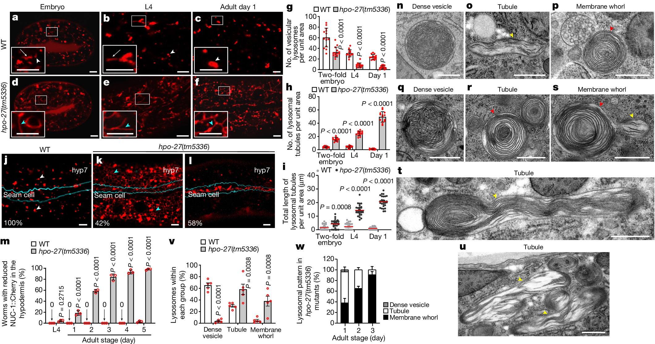 The HEAT repeat protein HPO-27 is a lysosome fission factor - Vimarsana News