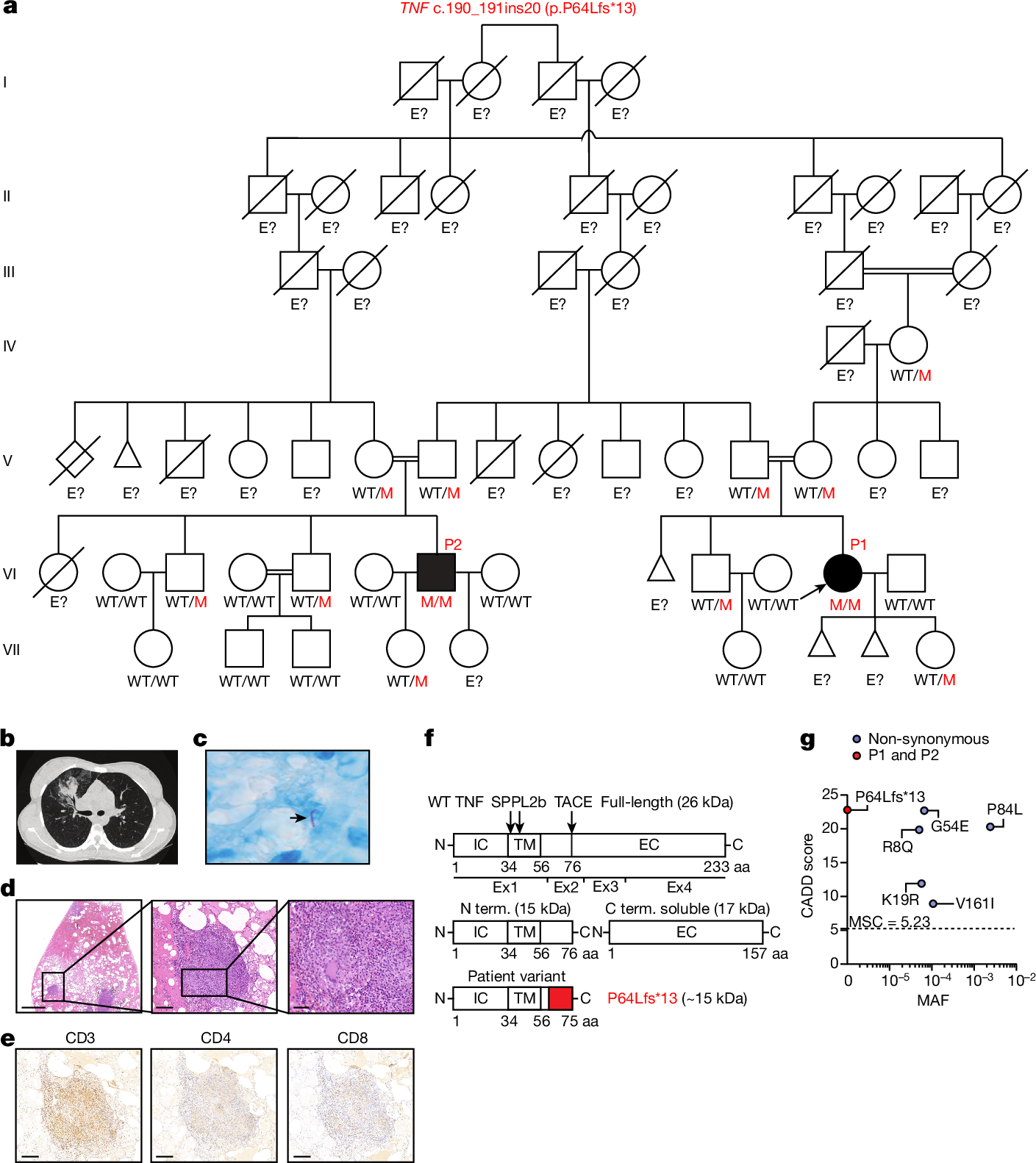 Tuberculosis in otherwise healthy adults with inherited TNF deficiency |  Nature