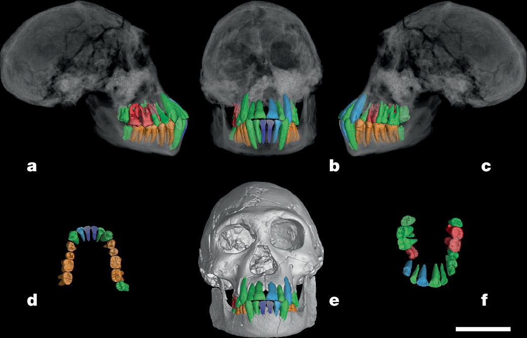 放射光が人類の幼年期の進化に新たな光を当てる(Synchrotron radiation sheds new light on the evolution of human childhood)