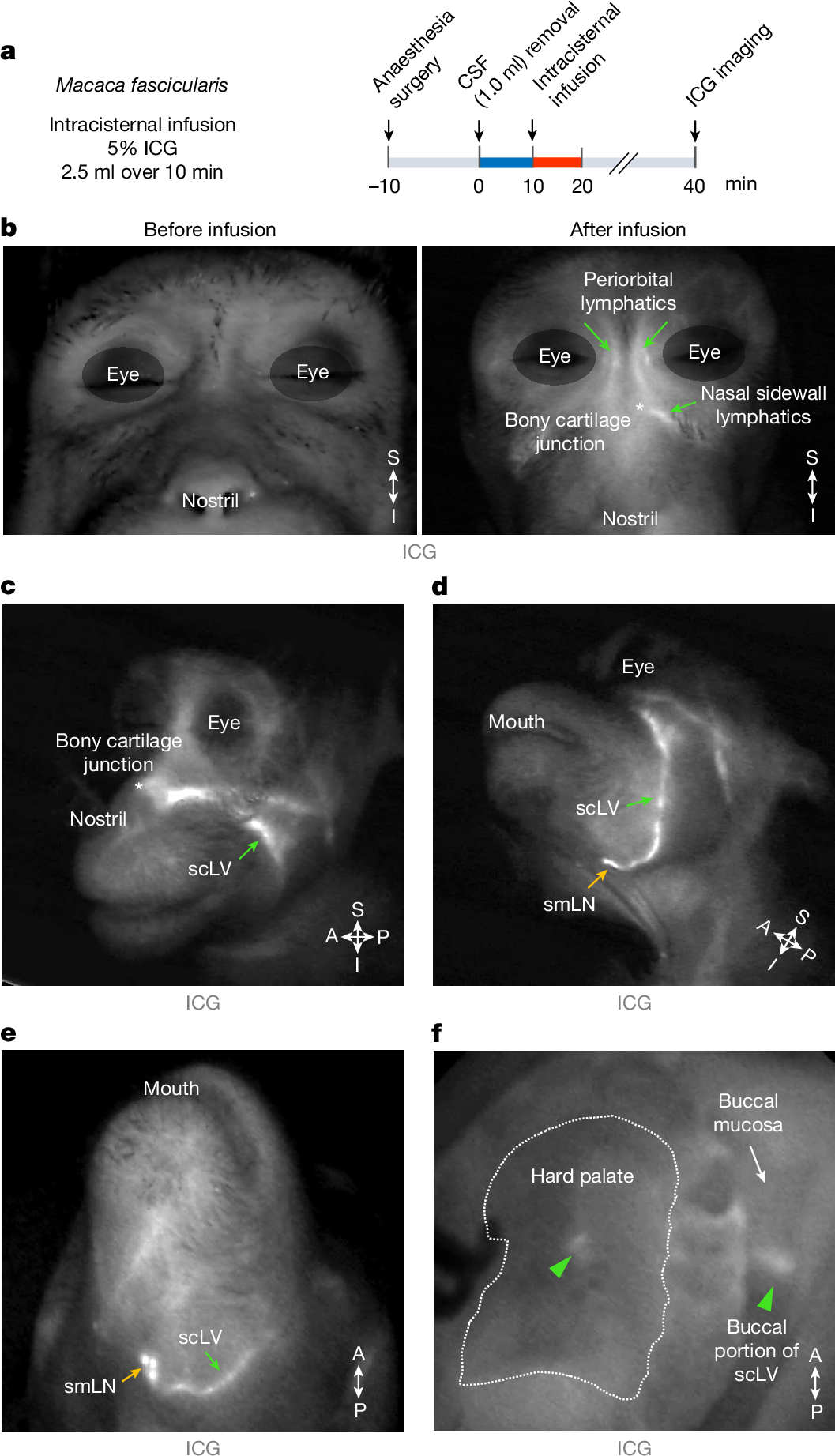 Fig. 4: CSF tracer in lymphatics around the eye and in the nasal sidewall, hard palate and superficial cervical regions of the monkey.