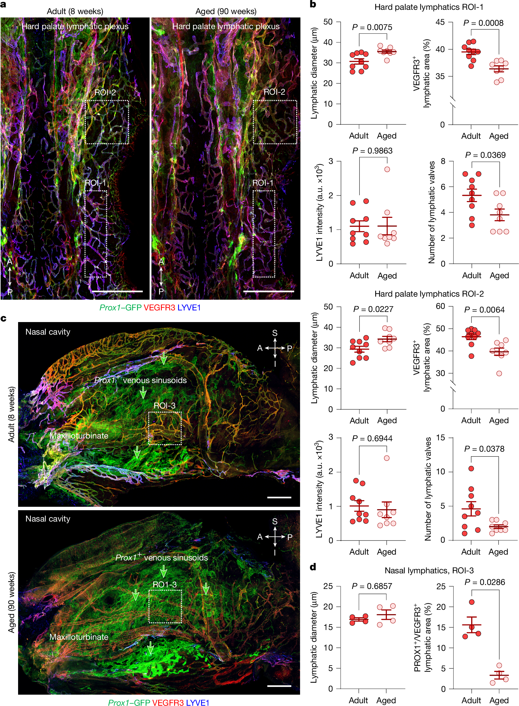 Fig. 5: Ageing-related changes in lymphatics of the nasal mucosa and hard palate.