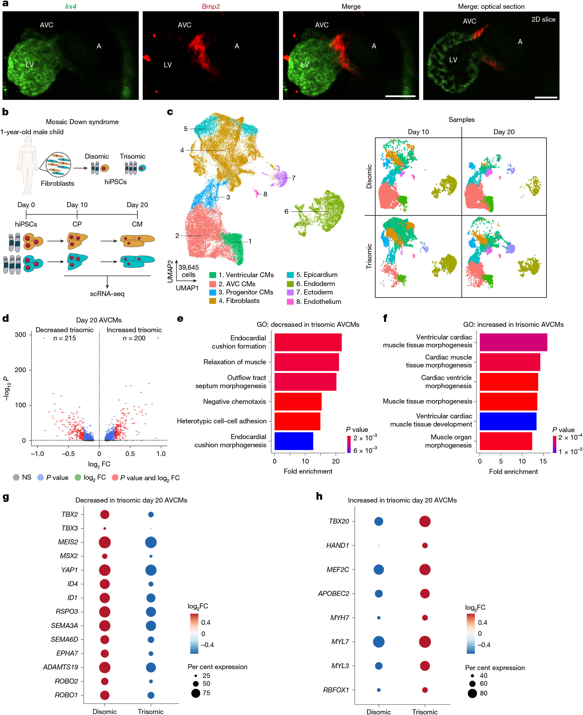 Myocardial reprogramming by HMGN1 underlies heart defects in trisomy 21 |  Nature