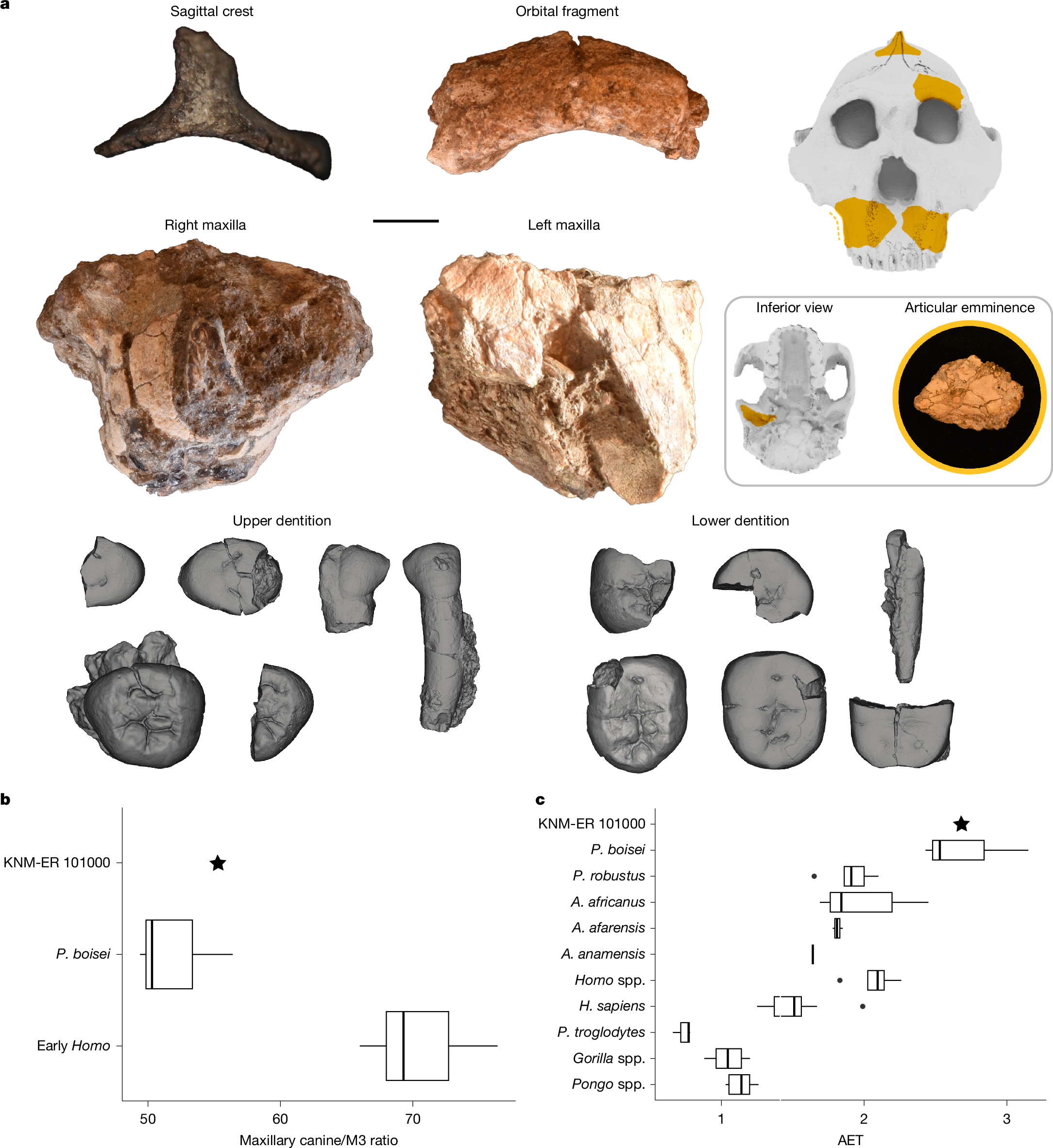 Fig. 2: KNM-ER 101000 craniodental remains.