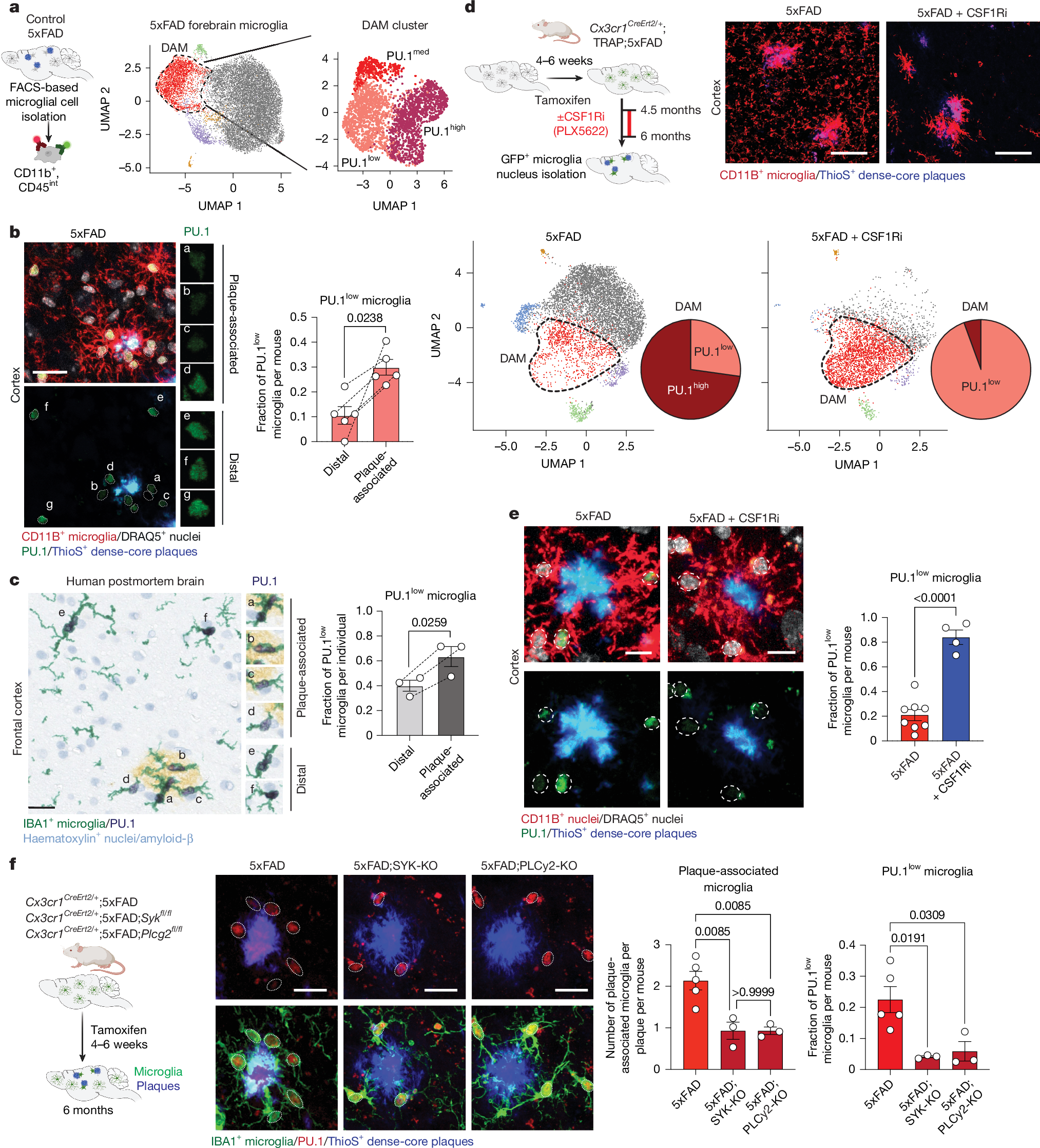 アルツハイマー病治療への新たな可能性:保護型ミクログリアを特定(Protective Microglia Subtype Offers Potential New Therapeutic Pathway in Alzheimer’s Disease)
